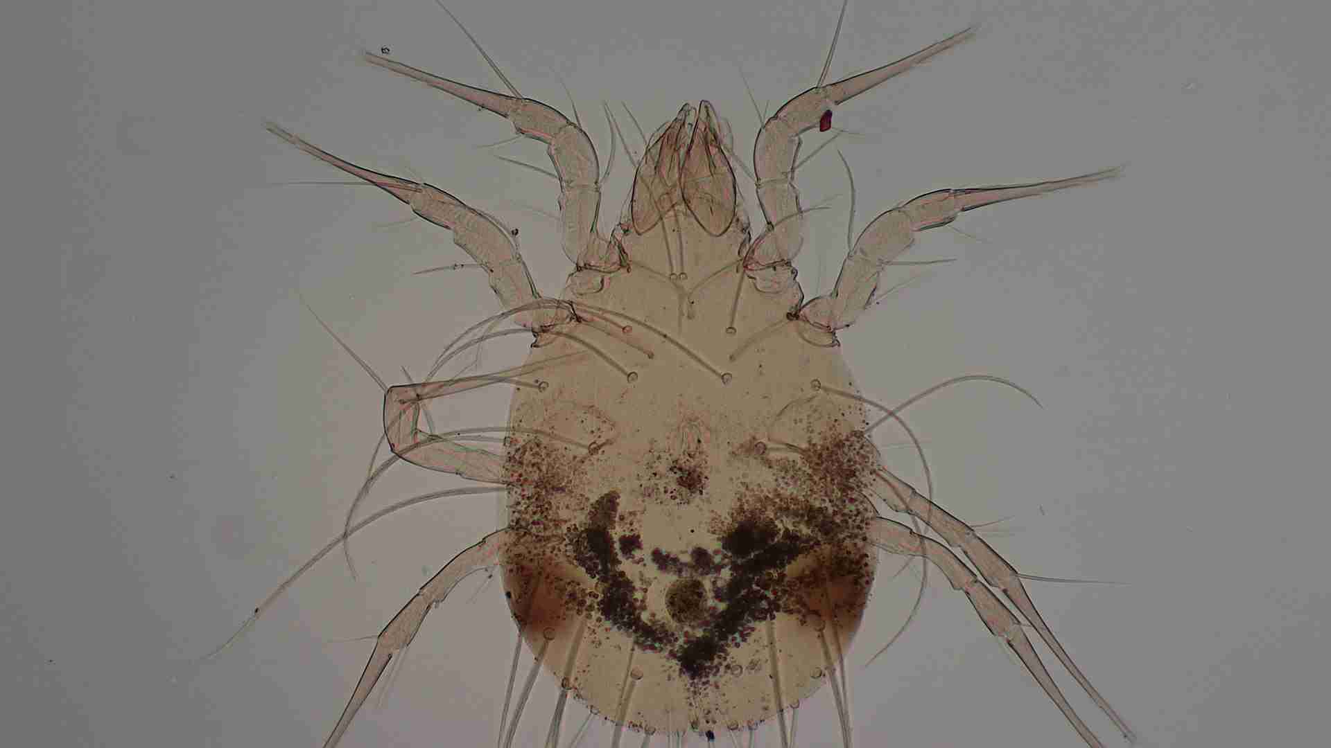 Glycyphagus